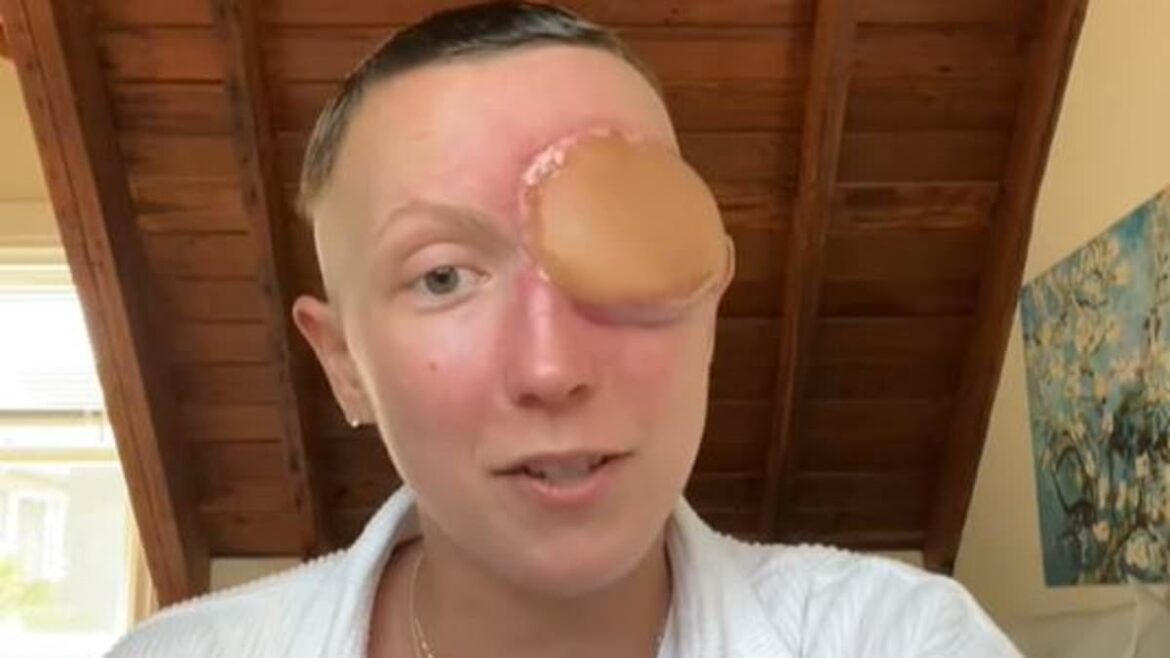 A 28-year-old suffers a 'sinus infection' that turned out to be a one-in-a-million nasal cancer - and doctors had to cut her eye out to save her